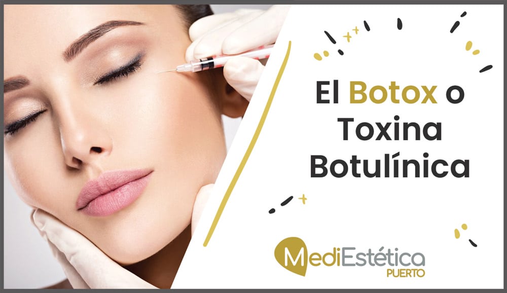 El Botox o Toxina Botulinica mediestética puerto