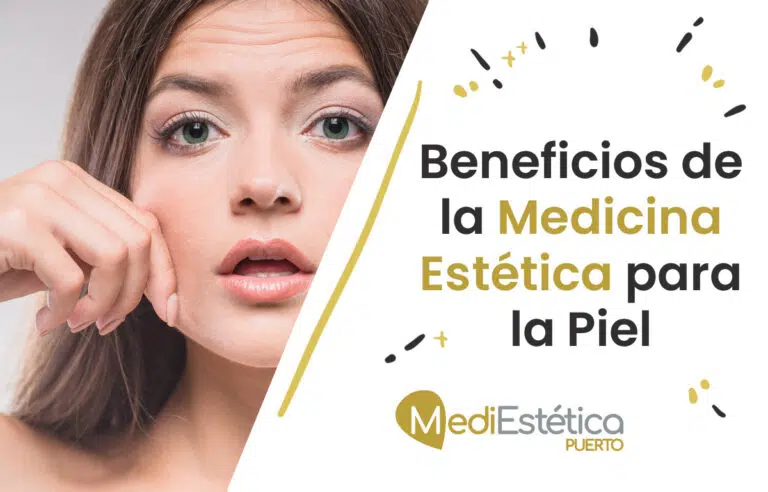 Beneficios de la Medicina Estética para la Piel