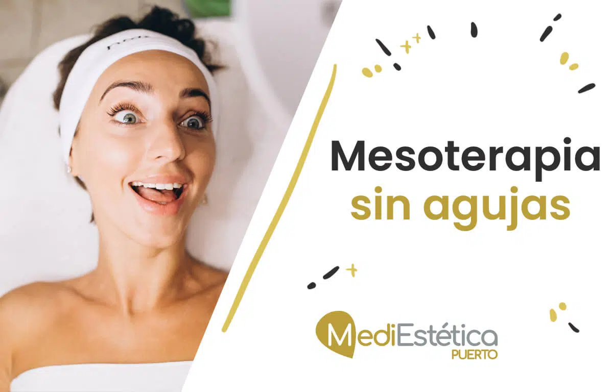 mesoterapia sin agujas cádiz