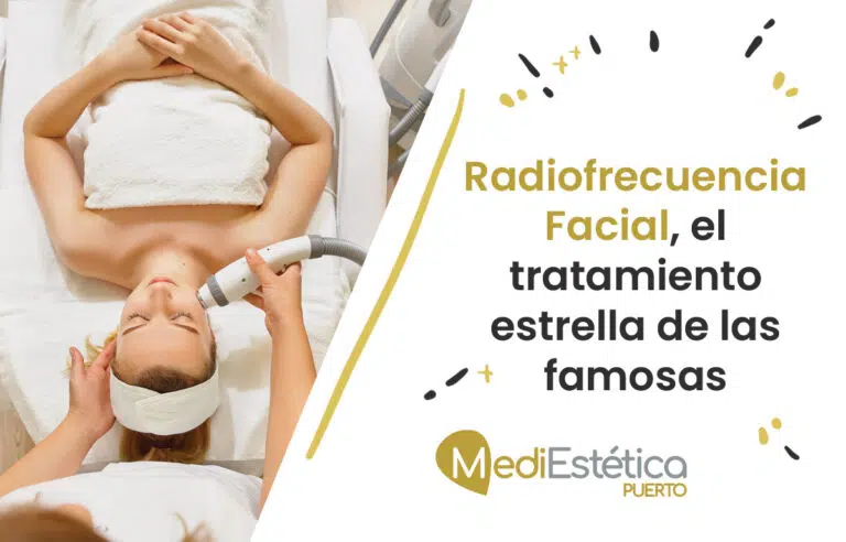 radiofrecuencia facial tratamiento medicina estética