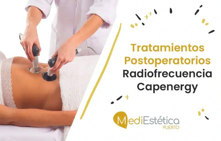 tratamientos postoperatorios radiofrecuencia