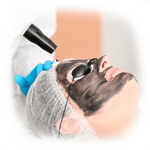 luz pulsada facial despues tratamiento