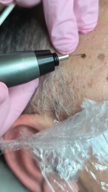 ¿Te preocupan las manchas de tu rostro o tus manos?
Nosotros tenemos la solución.Para más información:
☎️ 687 05 06 55
📍C/Serafín Álvarez Campana 2 El Puerto de Santa María#fisioterapia #nutricion #medicinaestetica #tratamientosestéticos #mediestetica #elpuerto #belleza #tratamientos #estetica #tratamientosfaciales #manchasenlapiel #manchas #eliminarmanchas #Arrugas #ElPuertodeSantaMaria #Elpuerto #CentroEstetico #EsteticaFacial #TratamientoFacial #Tratamiengoarrugas